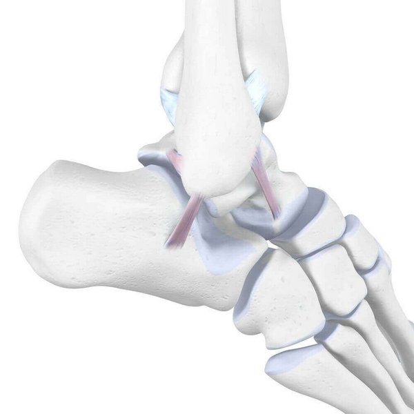 Darstellung der Anatomie des Sprunggelenks bei einer vorliegenden Bänderdehnung. Zu einer Bänderdehnung im Knöchel kommt es vor allem, wenn der Fuß übermäßig nach innen oder außen gedreht wird.